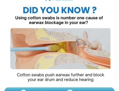 Top 3 Causes of Excessive Earwax Build-Up 